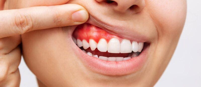 Periodontoloji